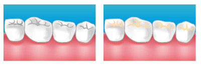 dentiste Paris 9