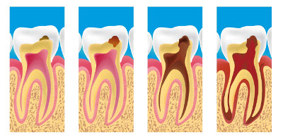 dentiste Paris 9ème